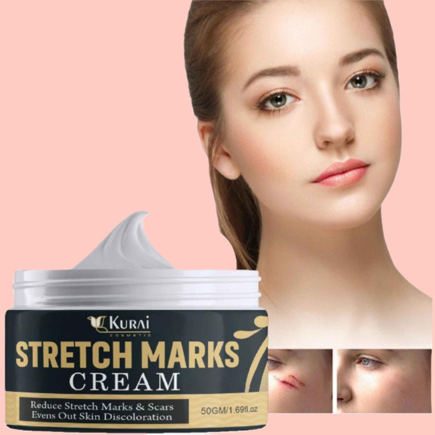 Bejoy  Pregnancy Scars, Acne Remove Cream (Pack of 2)