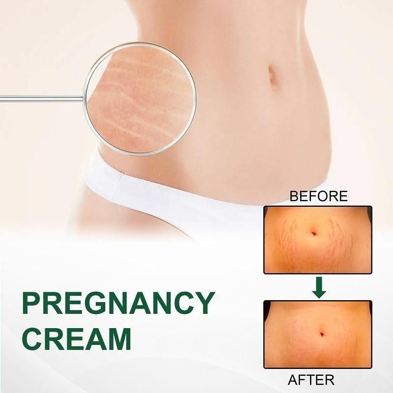 Bejoy  Pregnancy Scars, Acne Remove Cream (Pack of 2)